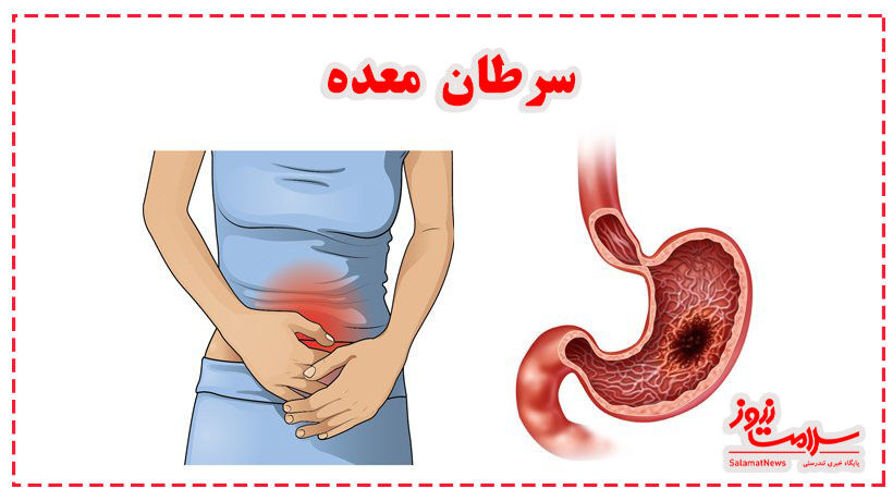 علل، علائم و راههای تشخیص و درمان سرطان معده را بشناسید علل، علائم و راههای تشخیص و درمان سرطان معده را بشناسید