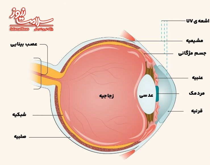 بیماری های شبکیه چشم را بشناسید