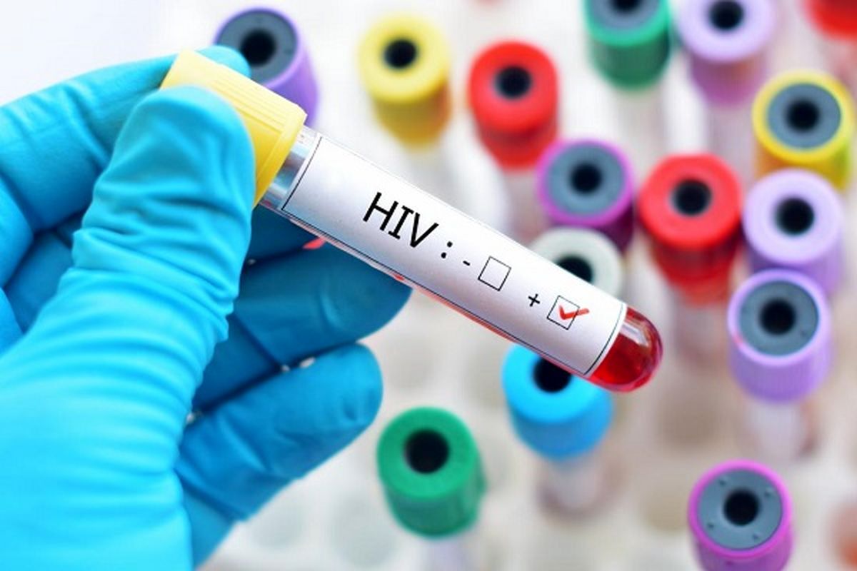 آخرین وضعیت بروز HIV در کشور