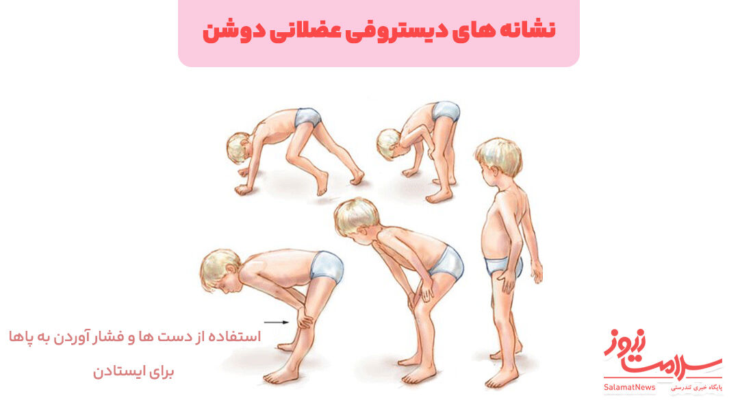 روش تشخیص و درمان دیستروفی عضلانی (DMD) چیست؟