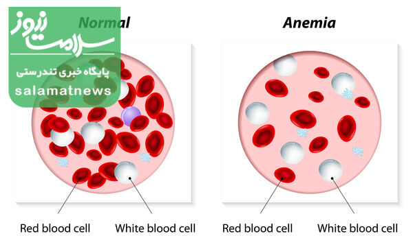 علت ابتلا به تالاسمی چیست؟چگونه درمان میشود؟