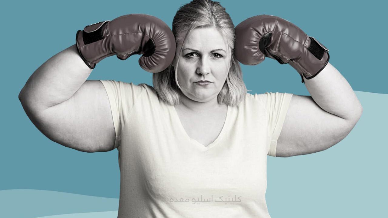 آیا عمل اسلیو معده واقعا تا 100% اضافه وزن را از بین می برد؟