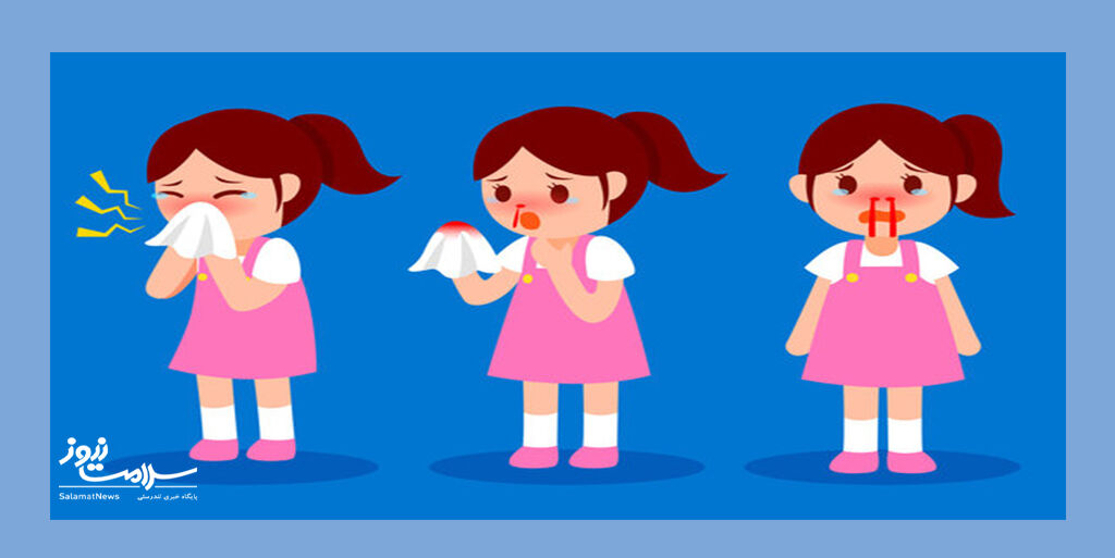 چه زمانی باید نگران خونریزی بینی باشید؟ چه زمانی باید نگران خونریزی بینی باشید؟