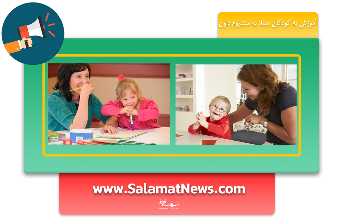 سندروم داون چیست؟