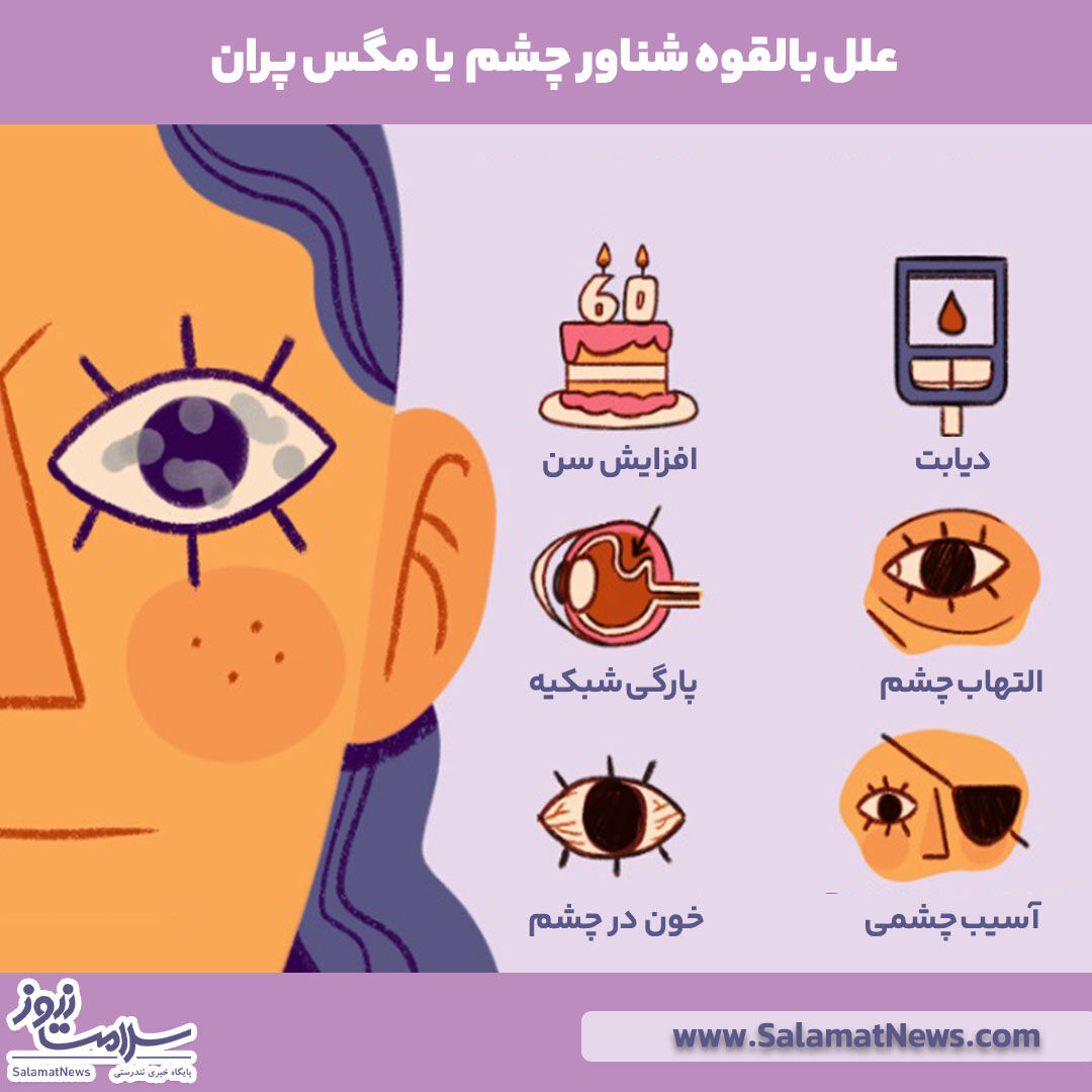 مگس پران چشم