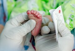 کمبود و گرانی تجهیزات نمونه‌گیری از پاشنه پا نوزادان / لزوم پوشش بیمه‌ای این خدمات