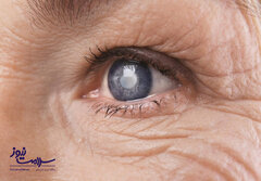 درباره انواع بیماری‌های شایع چشمی چه می‌دانید؟