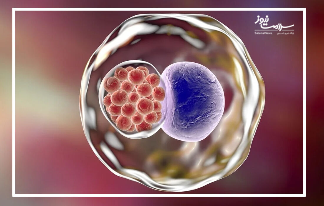 کلامیدیا شایع ترین عفونت مقاربتی از پیشگشیری تا درمان  کلامیدیا شایع ترین عفونت مقاربتی از پیشگشیری تا درمان