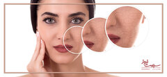 7 روش برای درمان خشکی پوست