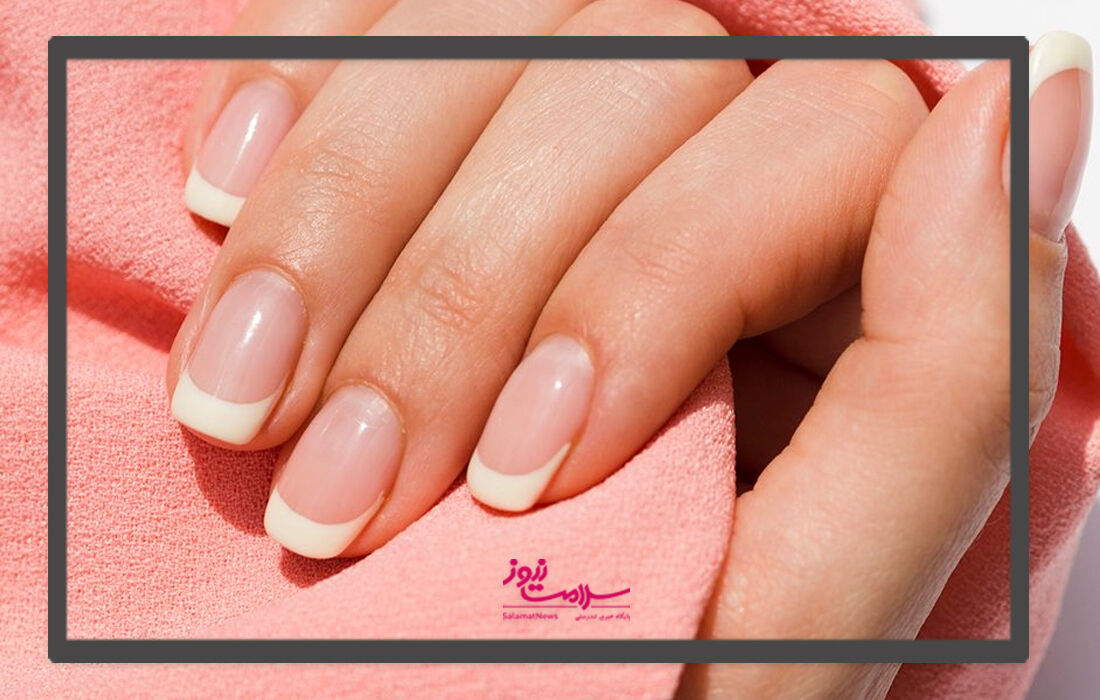 نکاتی که باید قبل از کاشت ناخن بدانید  نکاتی که باید قبل از کاشت ناخن بدانید
