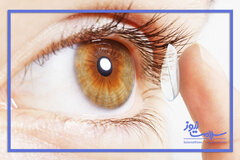 کوری و عفونت های چشمی از عوارض استفاده از لنزهای تماسی