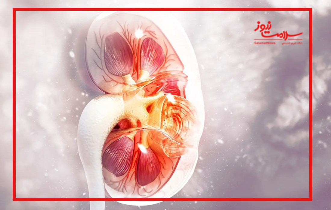 سرطان کلیه ، پیشگیری،تشخیص و درمان سرطان کلیه ، پیشگیری،تشخیص و درمان