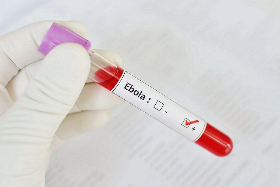 ویروس ابولا در بدن چکار می‌کند؟