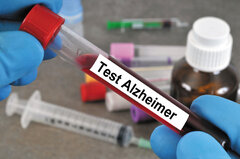 تشخیص آلزایمر فقط با یک آزمایش خون ساده