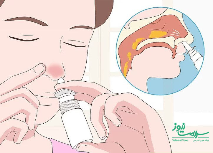 9 ترفند ساده برای درمان فوری گرفتگی بینی