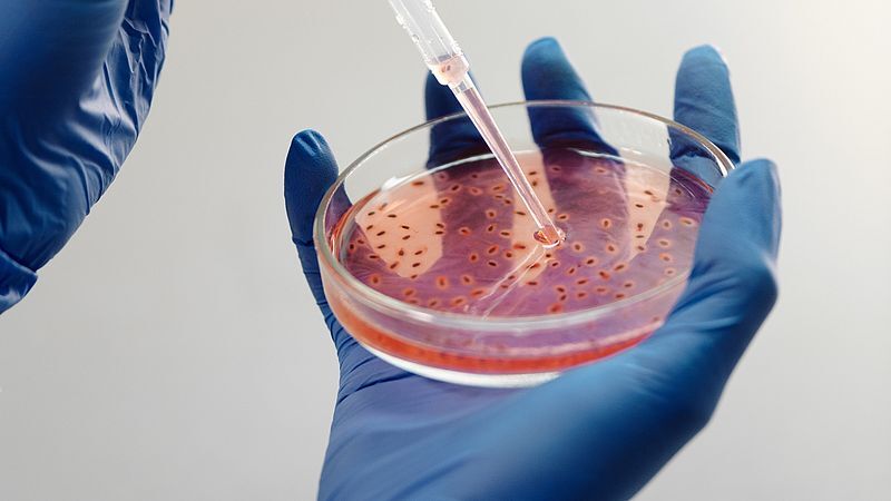 سلول های بنیادی بهتر از دارو بیماری ام اس را کُند می کند سلول های بنیادی بهتر از دارو بیماری ام اس را کُند می کند