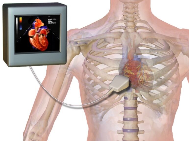 اکوکاردیوگرافی چطور انجام می شود؟ اکوکاردیوگرافی چطور انجام می شود؟