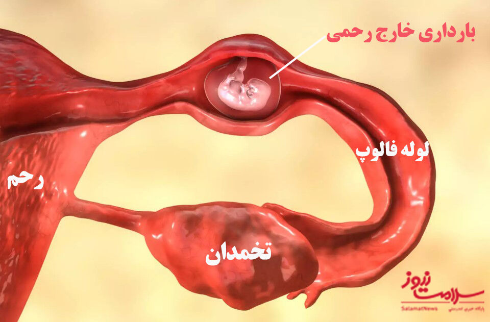 عکس/۱۴ علت لکهبینی در دوران بارداری