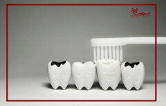 دلایل پوسیدگی دندان با وجود رعایت بهداشت دهان و دندان