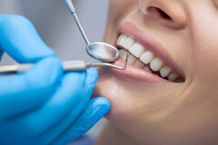 ضرورت مشارکت دانشکده‌های دندانپزشکی در ارتقای شاخص‌های سلامت دهان و دندان