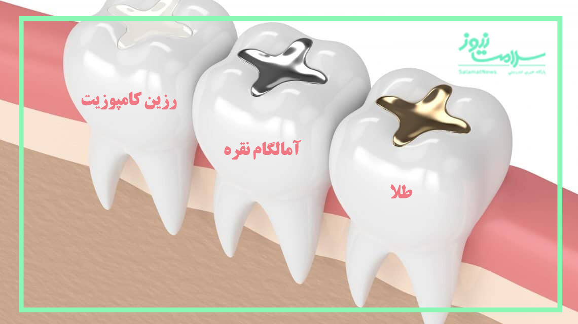 درمان زودهنگام پوسیدگی های دندان
