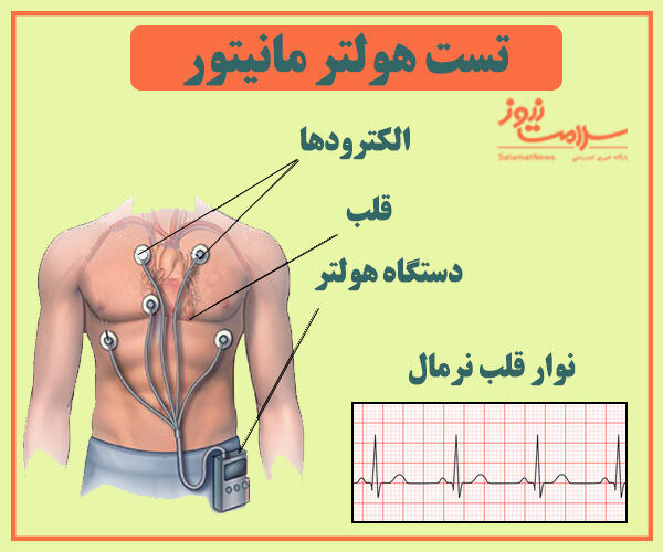 هر چیزی که باید درباره تست هولتر مانیتور بدانید
