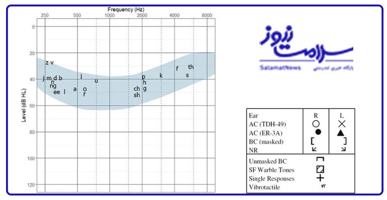 بررسی انواع مختلف شنوایی سنجی
