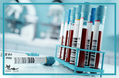 آزمایش گاز خون چیست و  برای چه کاری استفاده می شود؟