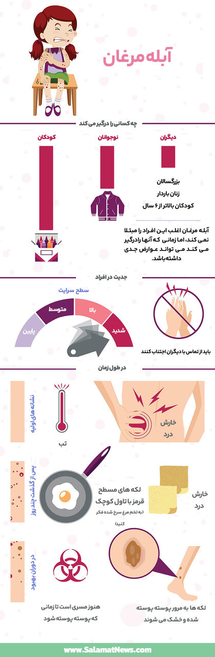 آبله مرغان