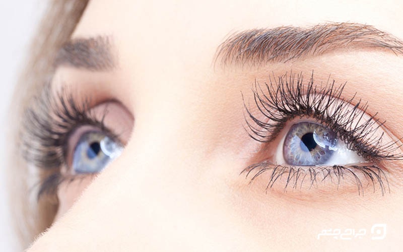 عمل لازک چشم و عوارض آن