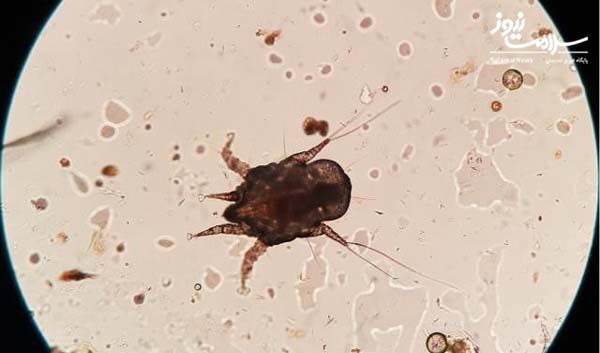 با دیدن این تصاویر دیگر از هدست مشترک استفاده نمی کنید