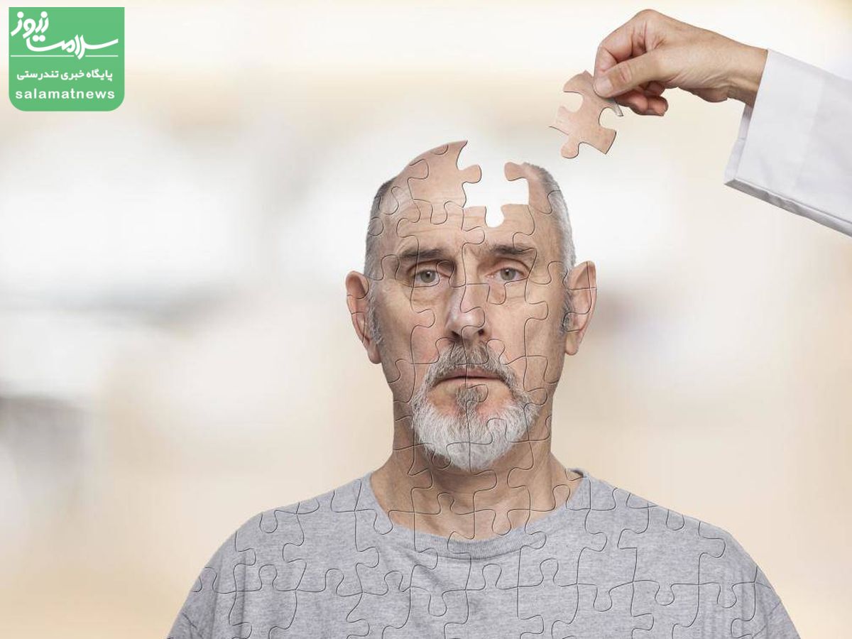 بیماران آلزایمری نیازمند حمایت های بیمهای هستند بیماران آلزایمری نیازمند حمایت های بیمهای هستند