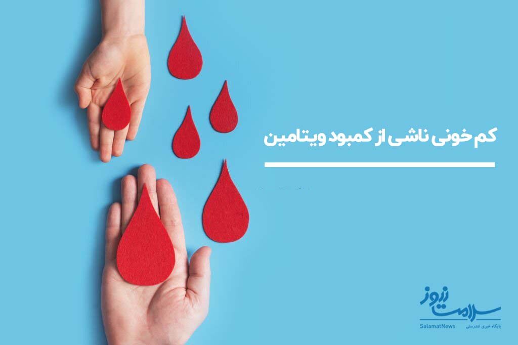 کم خونی ناشی از کمبود ویتامین کم خونی ناشی از کمبود ویتامین