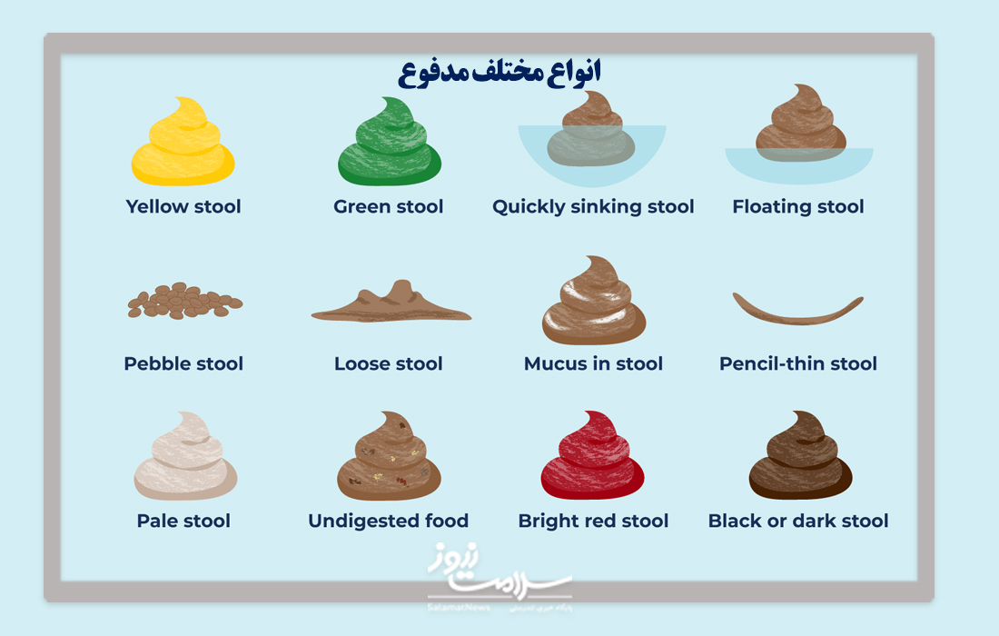 مدفوع سیاه نشانه بیماری است؟