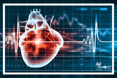 برخی گجت های پوشیدنی با دستگاه های الکترونیکی قلب تداخل دارند