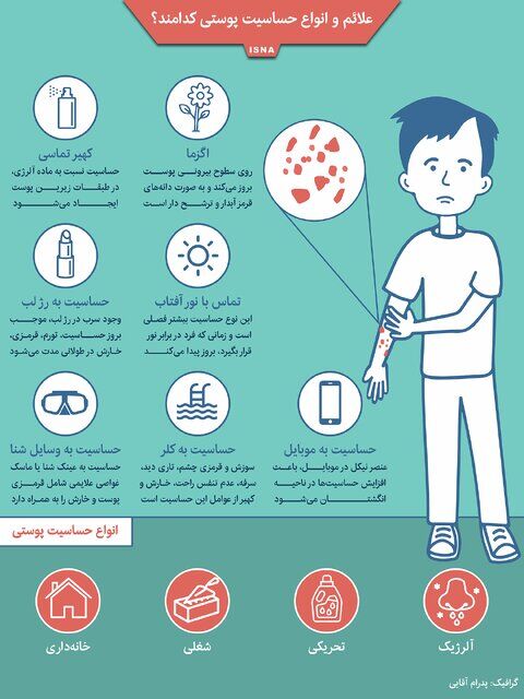 اینفوگرافیک / علائم و انواع حساسیت پوستی کدامند؟