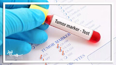تست های تومور مارکر برای سرطان