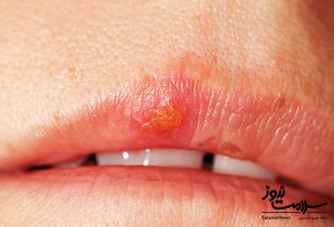 عفونت های پوستی: آنچه لازم است بدانید!