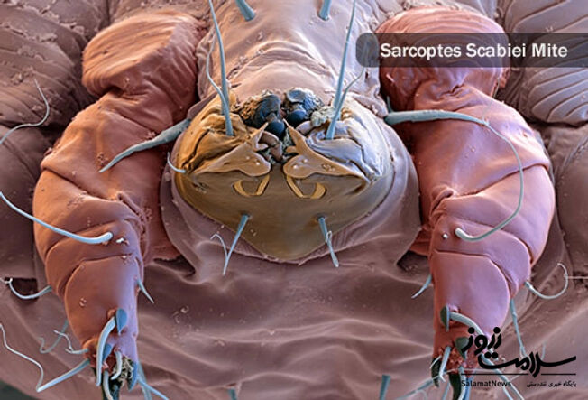 عفونت های پوستی: آنچه لازم است بدانید!