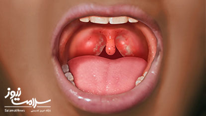 تست سریع استرپ چه کاربردی دارد؟