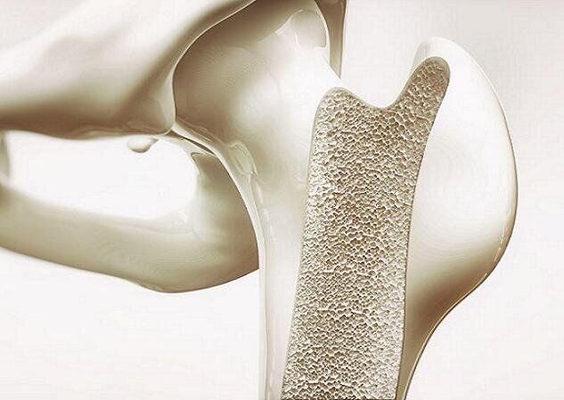 اینفوگرافیک / چند هشدار درباره پوکی استخوان در مردان