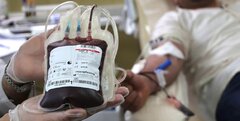 محدوده مجاز فشارخون برای اهدای خون چقدر است؟