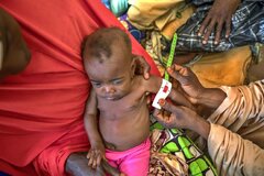 سوء تغذیه بیش از یک میلیارد زن و دختر در جهان