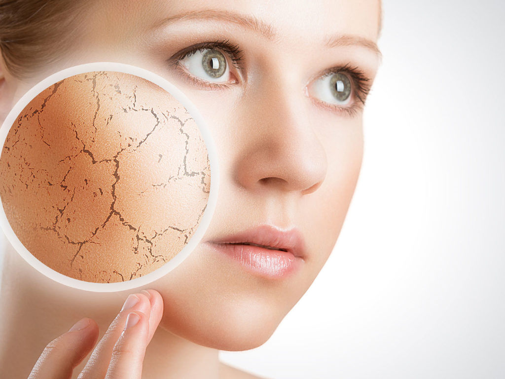 ۶ راهکار برای جلوگیری از خشکی پوست ۶ راهکار برای جلوگیری از خشکی پوست