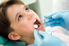 کودکان قبل از ورود به دبستان ۵ دندان پوسیده دارند