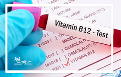 چه افرادی به تزریق آمپول ویتامین B۱۲ نیاز دارند؟