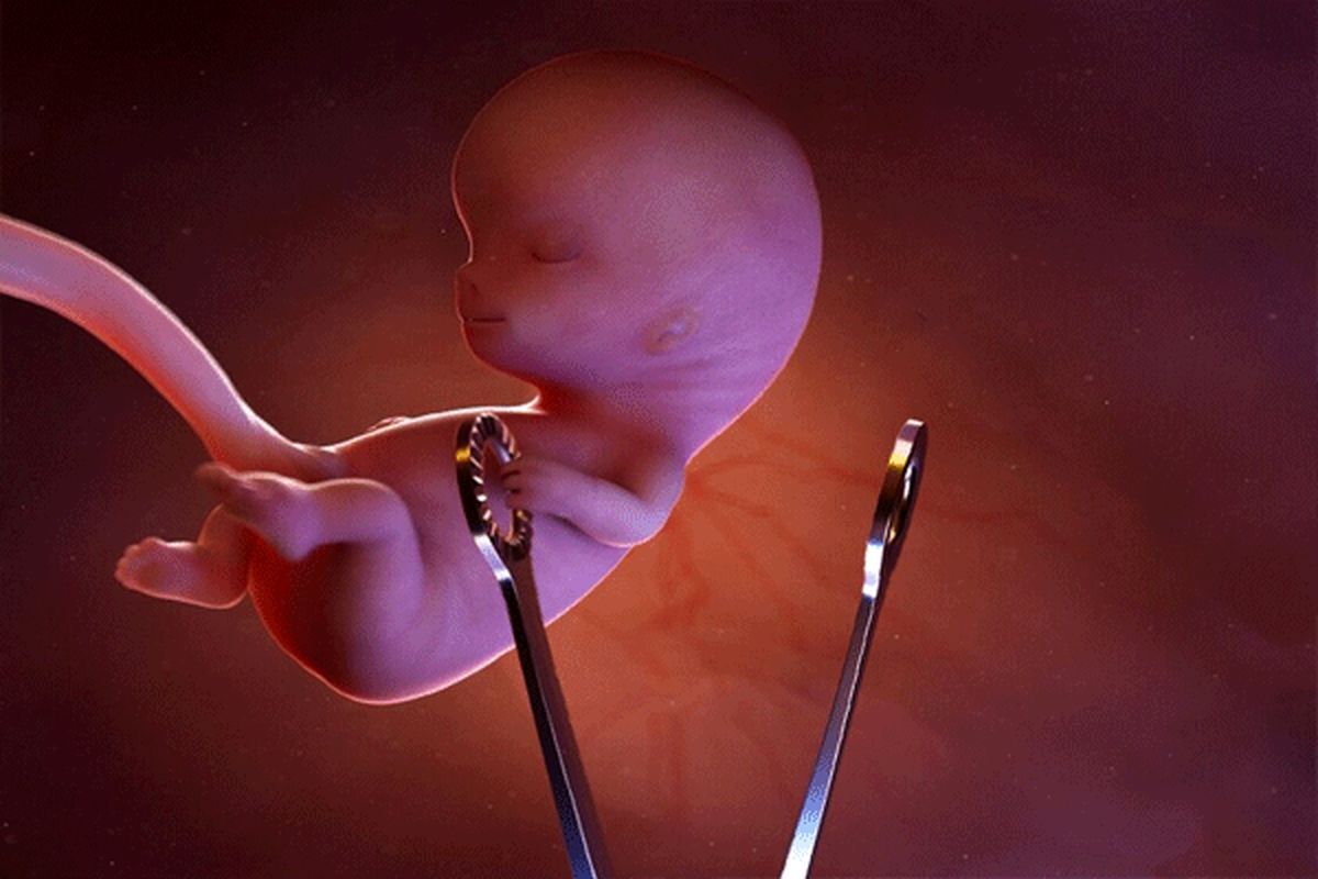 سقط جنین، از عوامل کاهش نرخ جمعیت است