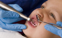 آیا دندان شیری ارزش توجه کردن دارد؟