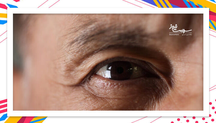 هر عضوِ بدن ممکن است سکته کند هر عضوِ بدن ممکن است سکته کند