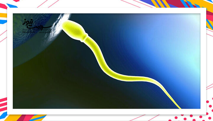 اسپرم زرد نشانه چیست؛ علت زردشدن مایع منی